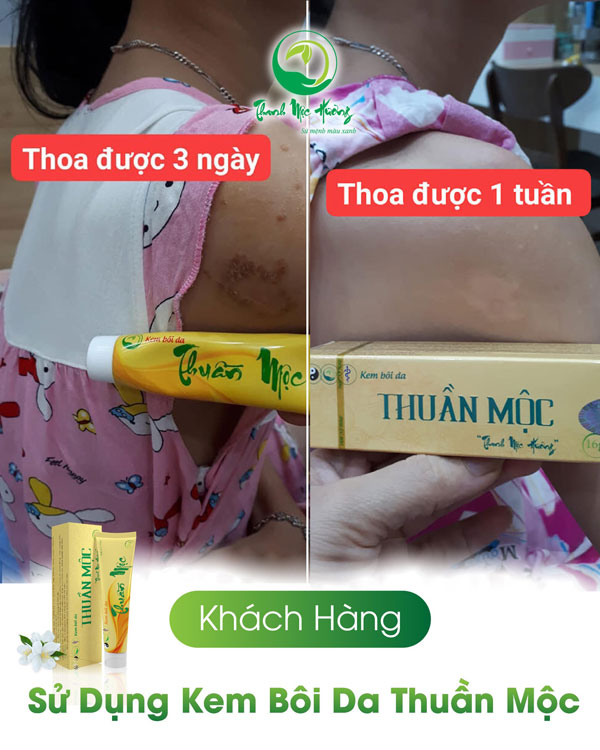 Feedback Thuan Moc 2
